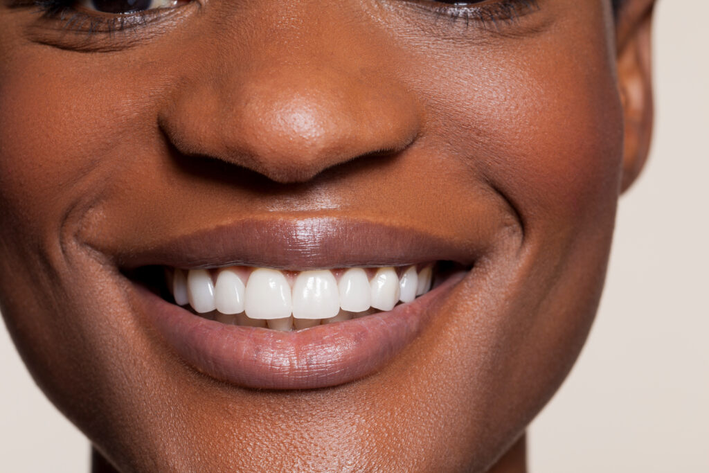 Close up of female toothy smile