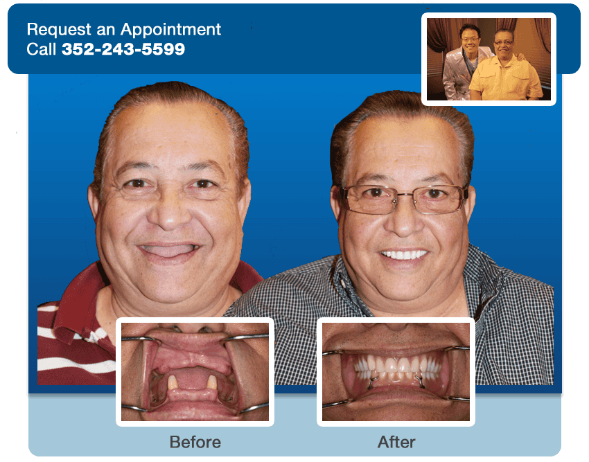 dental orlando