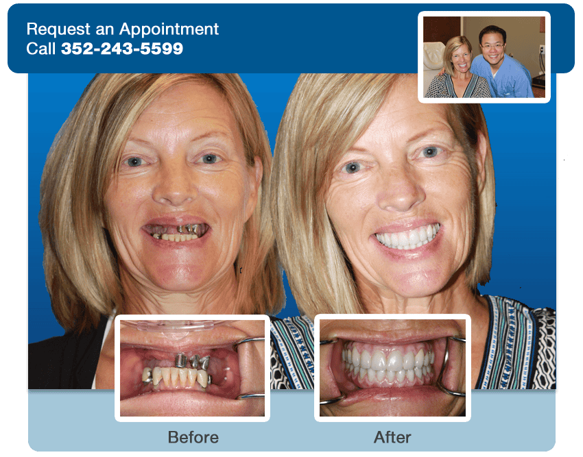 dental lake nona