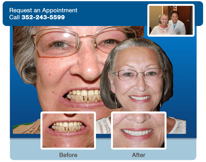 dental orlando