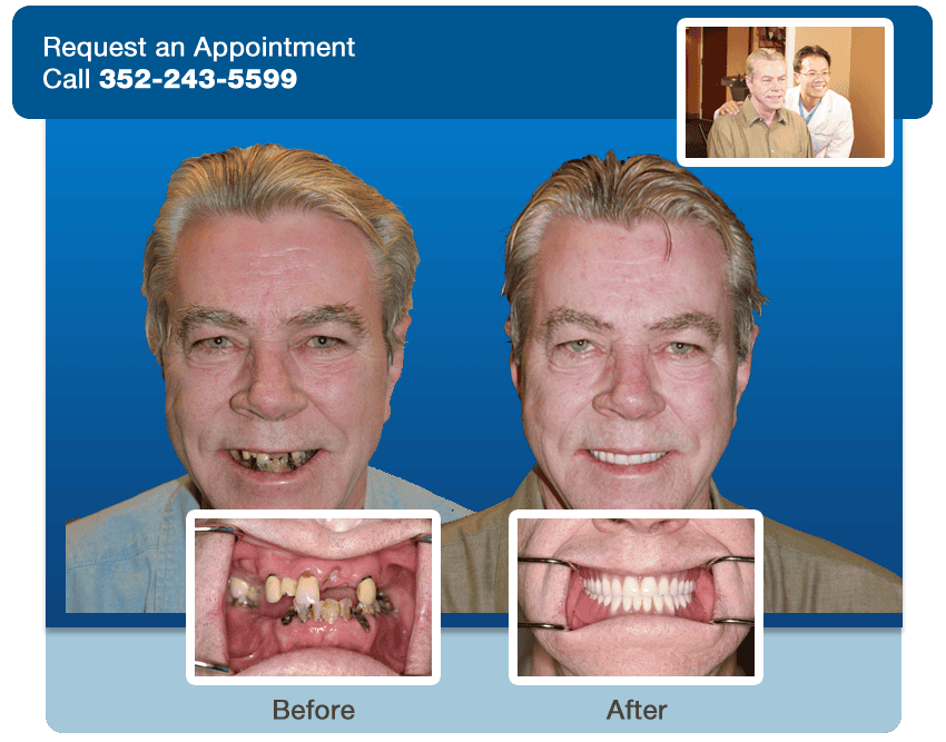 dental lake nona