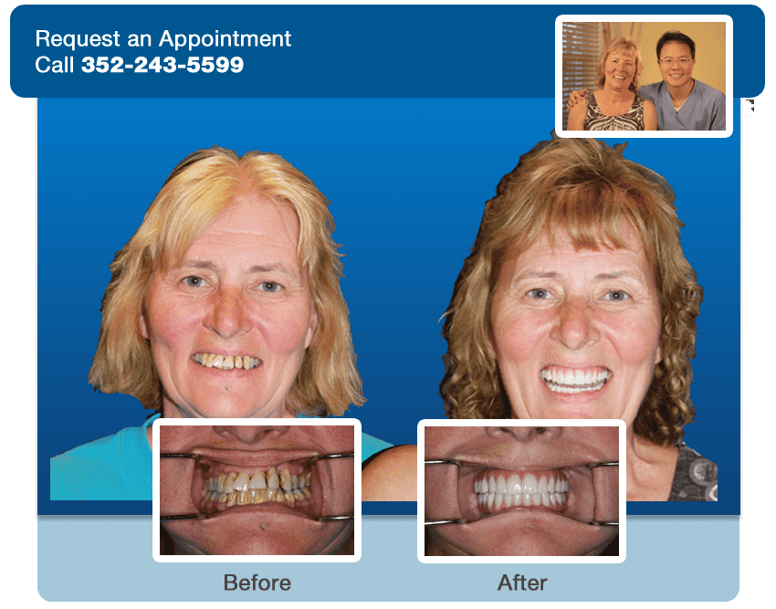 dental orlando