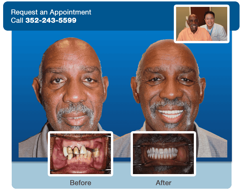 dental lake nona