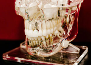 dental implants and oral surgery