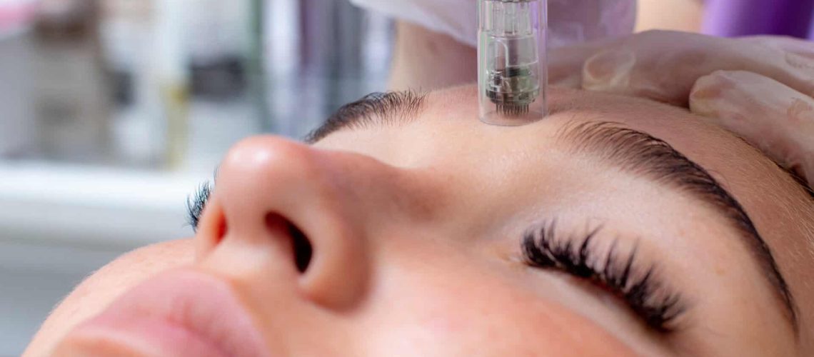 Fractional microneedle facial therapy close up