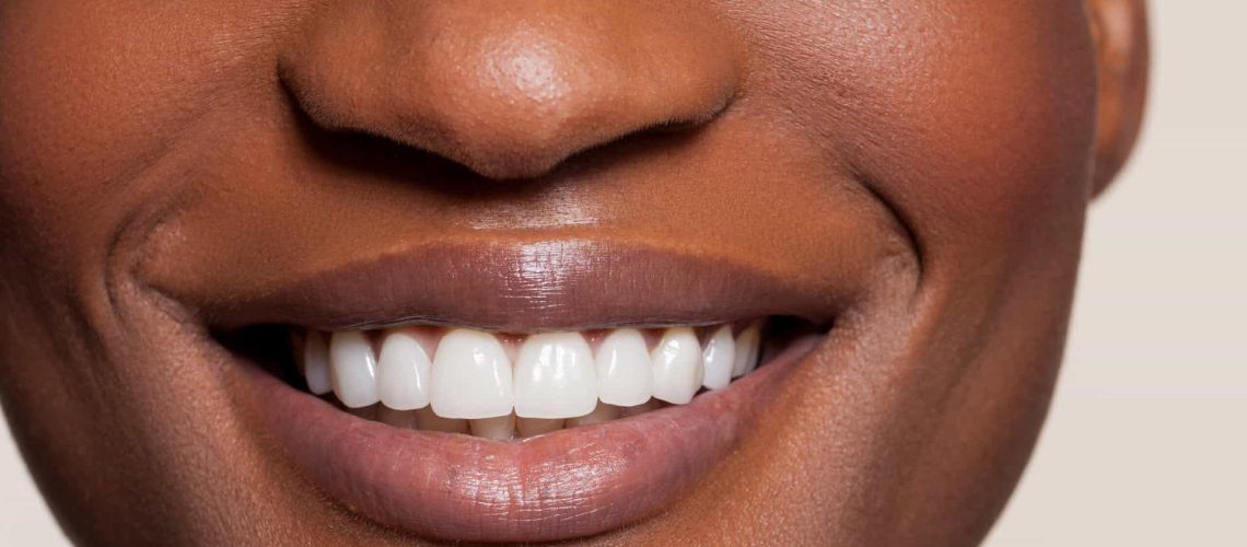 Close up of female toothy smile