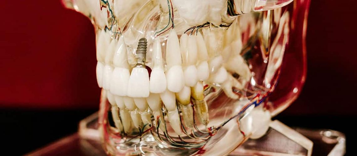 dental implants and oral surgery