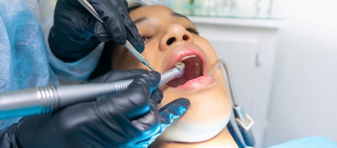 sedation dentistry Orlando