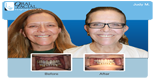 orlando maxillofacial surgeon