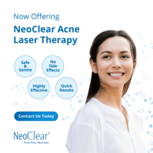 NeoClear Acne Laser Therapy for ingrown hair treatment