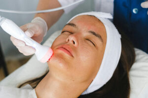 neoskin facial treatment