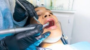 sedation dentistry Orlando